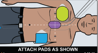 AED Plus Step 2
